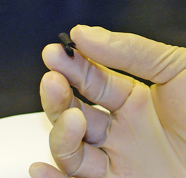 Battery using body fluids Battery using body fluids